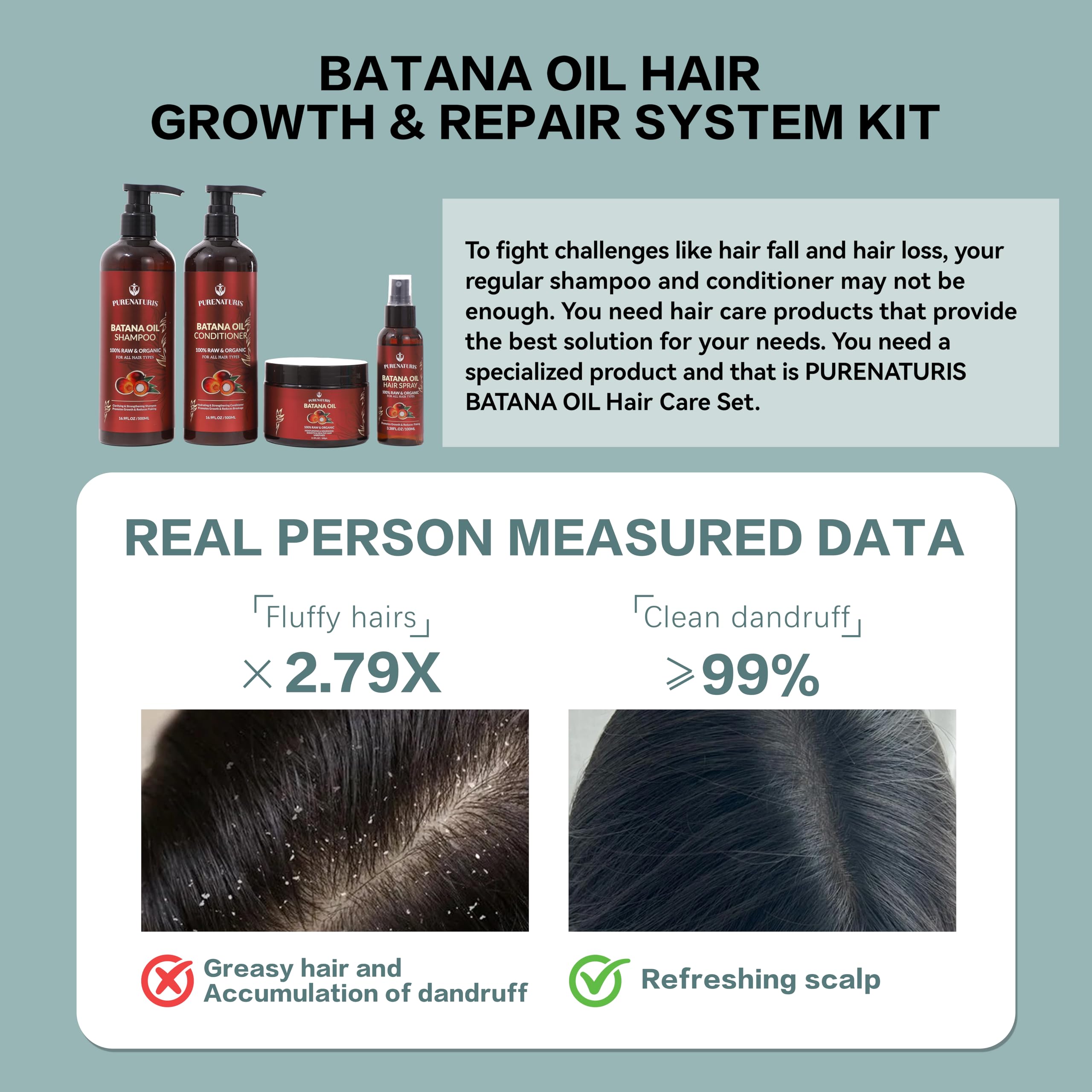100% Natural Raw Organic Batana Oil Sulfate-Free Complete Hair Growth , Anti-Hair Loss & Repair System Kit – Shampoo, Conditioner, Hair Mask, & Leave-In Spray | Thickness & Prevents Loss for Men Women